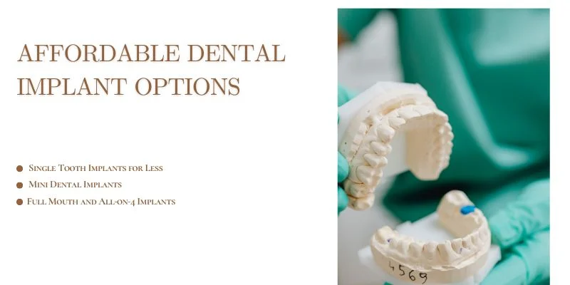 Affordable Dental Implant Options