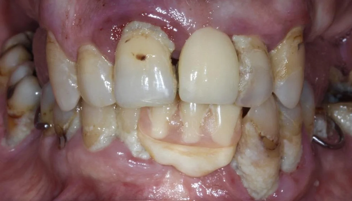 Before and After - Case 01 - B