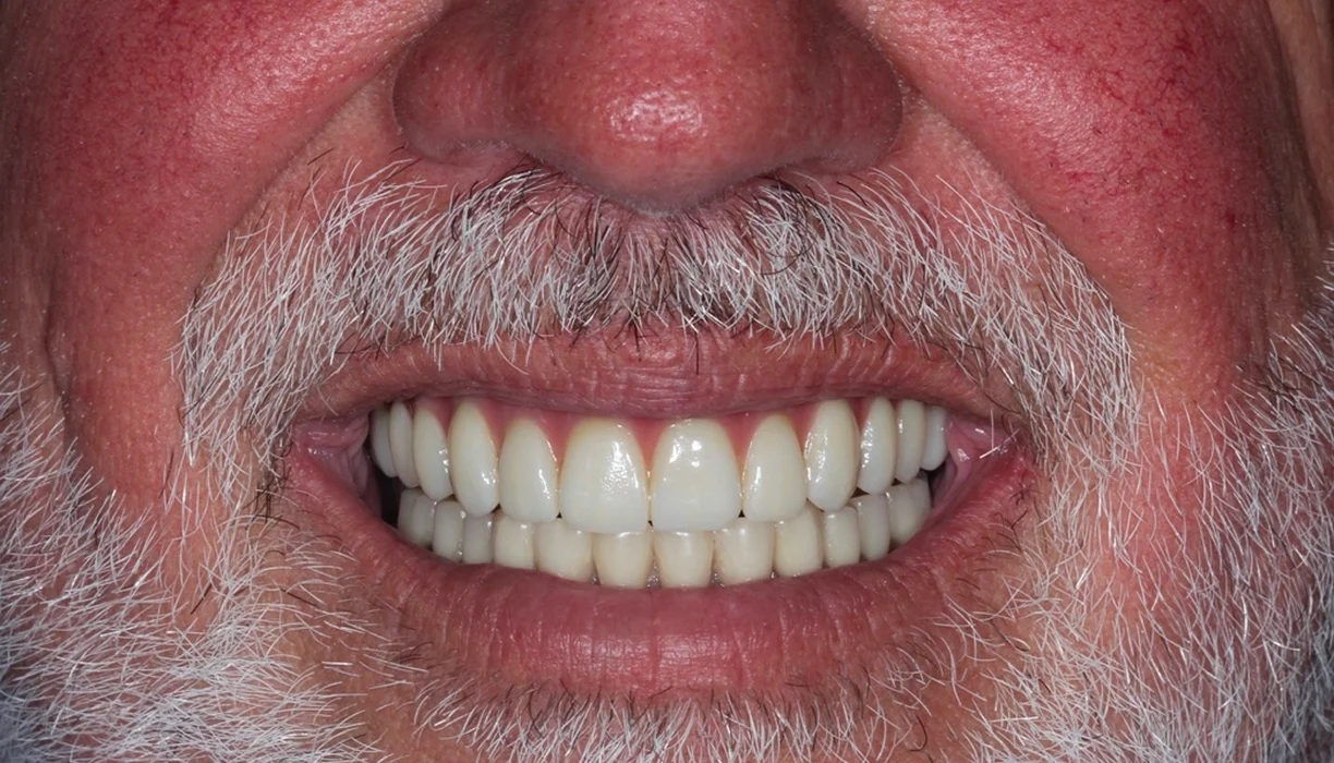 Before and After - Case 02 - A