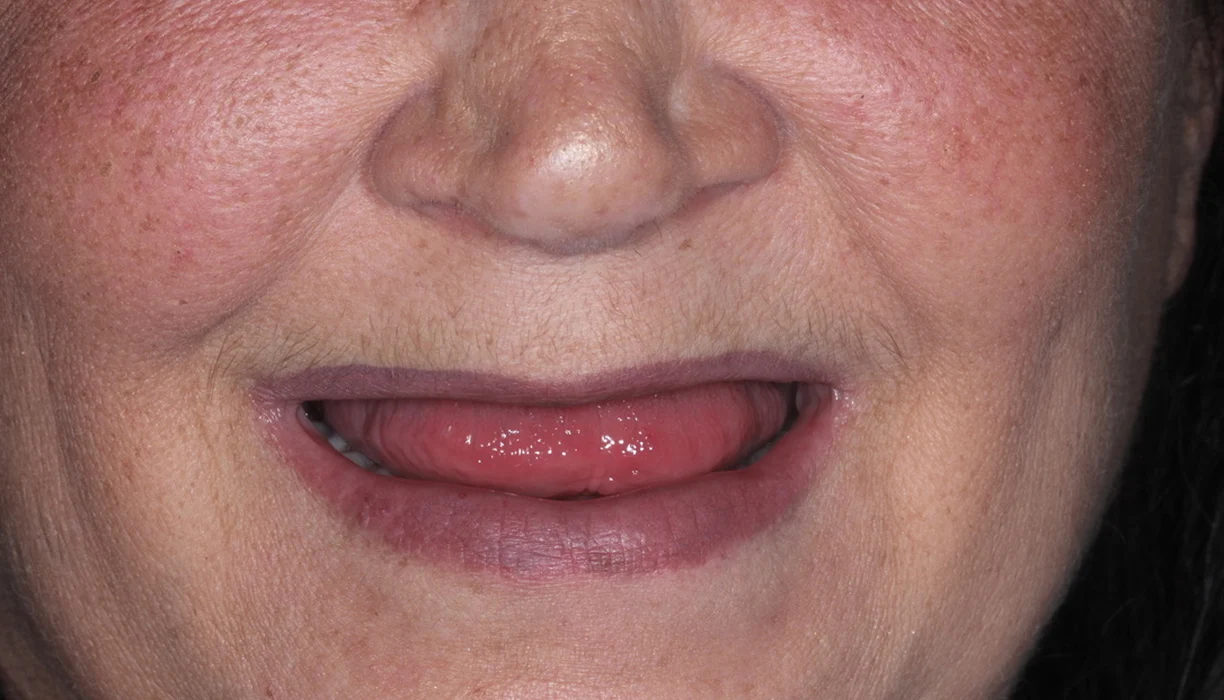 Before and After - Case 03 - B