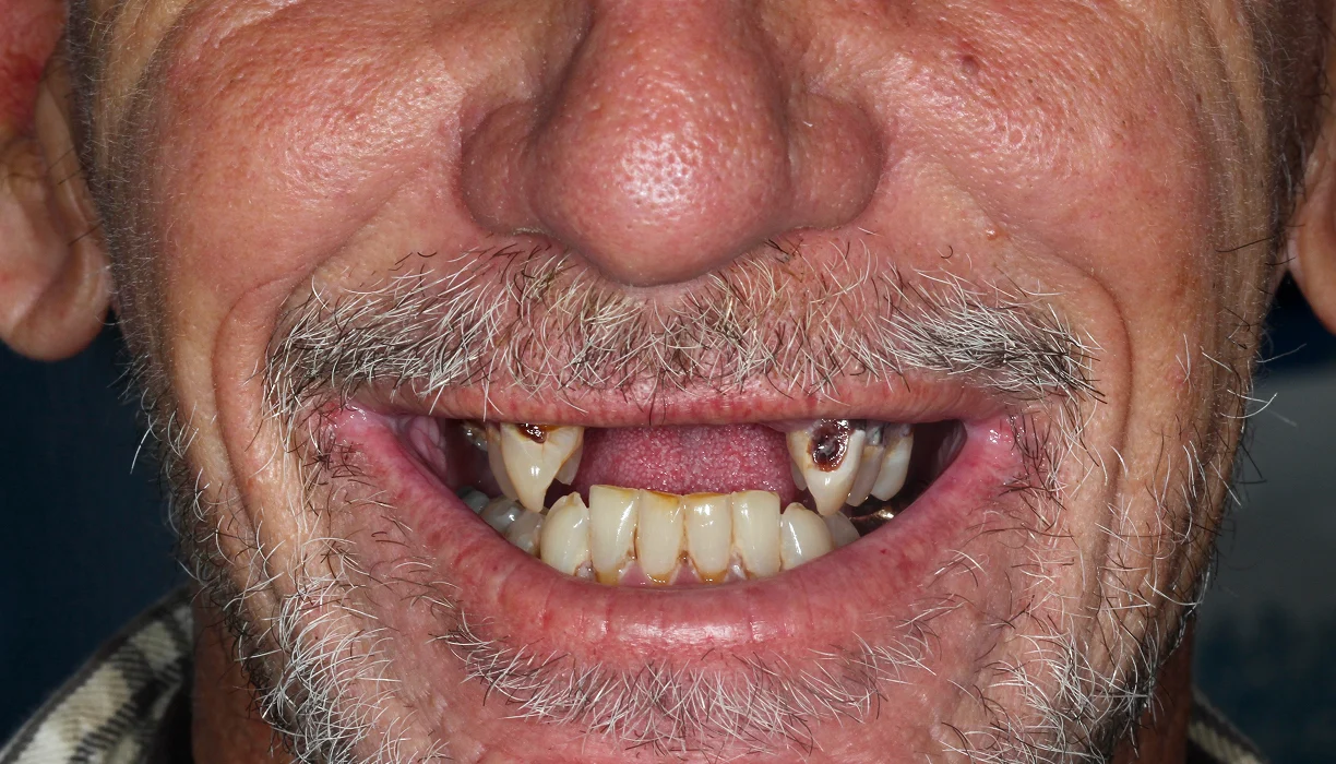 Before and After - Case 05 - B