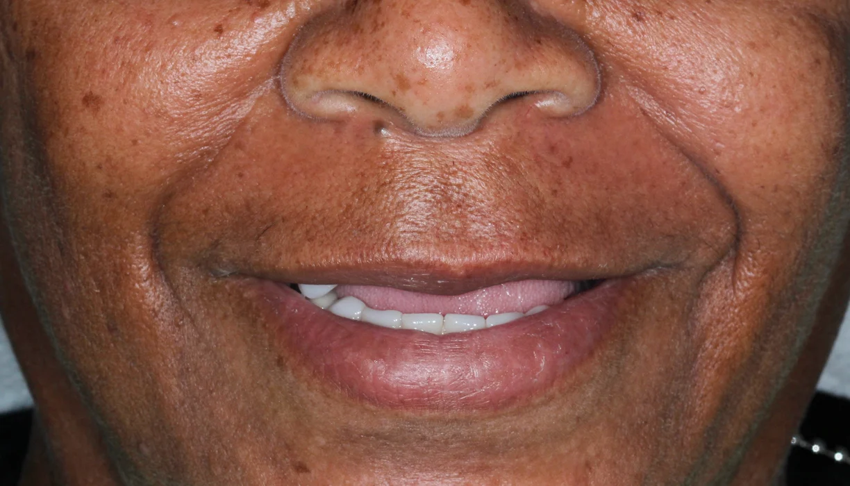 Before and After - Case 07 - B