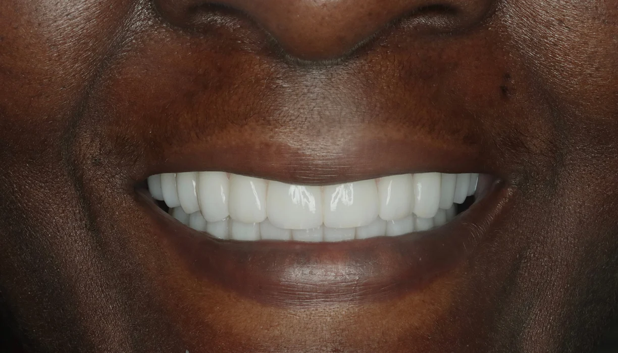 Before and After - Case 08 - A