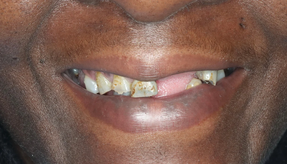 Before and After - Case 08 - B