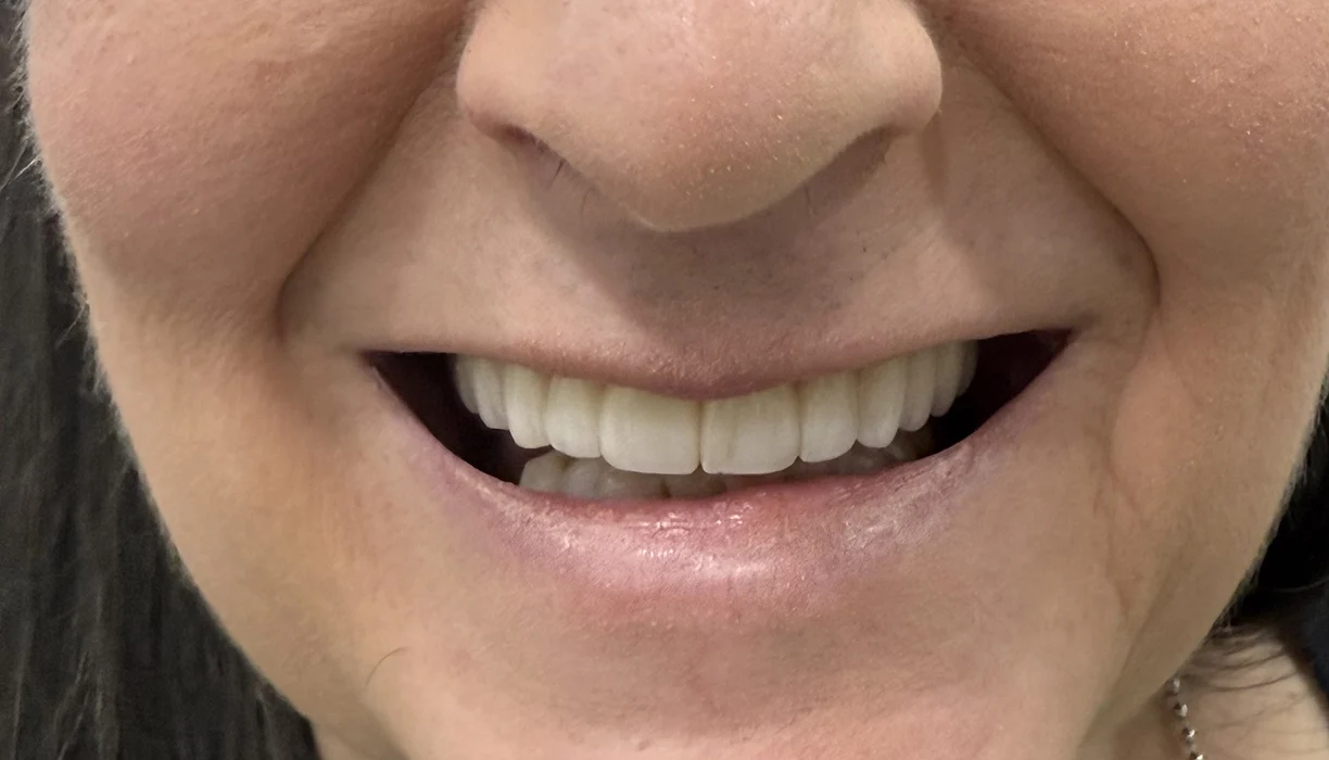 Before and After - Case 09 - A