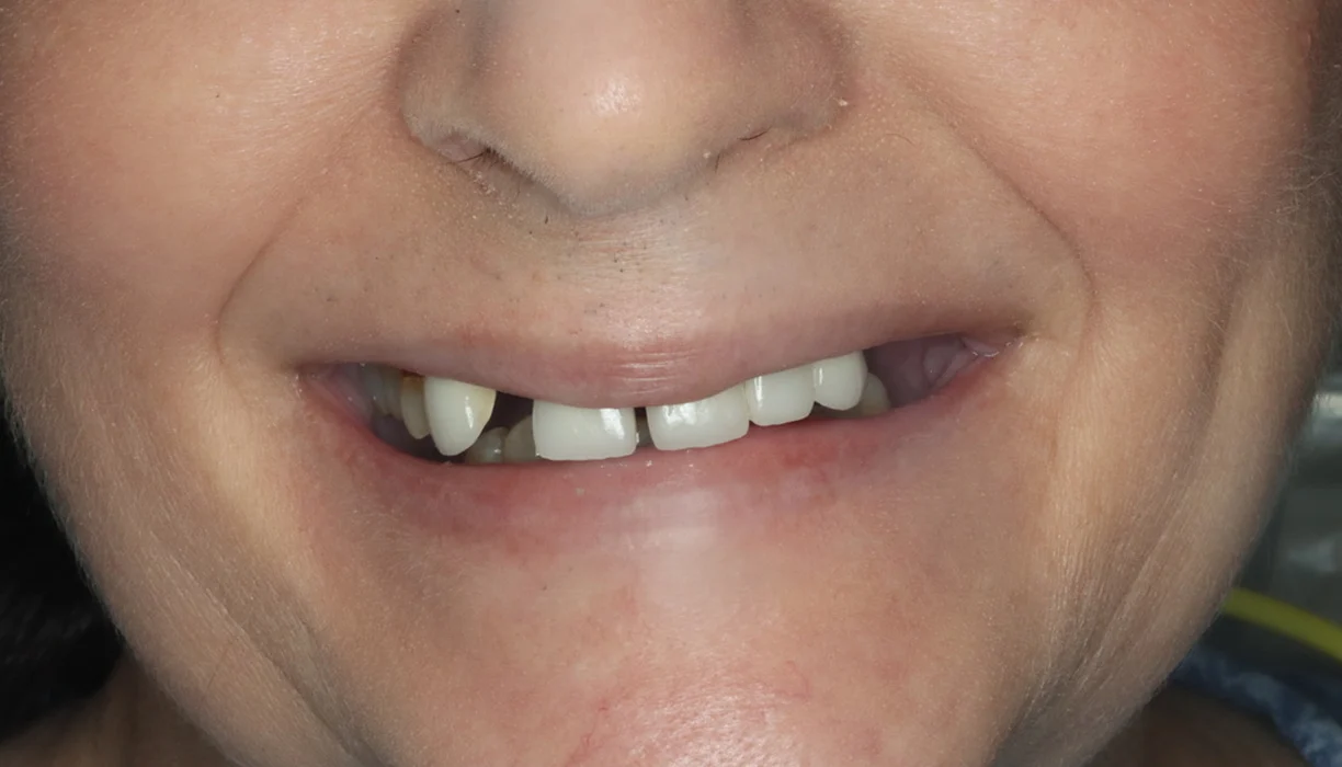 Before and After - Case 09 - B