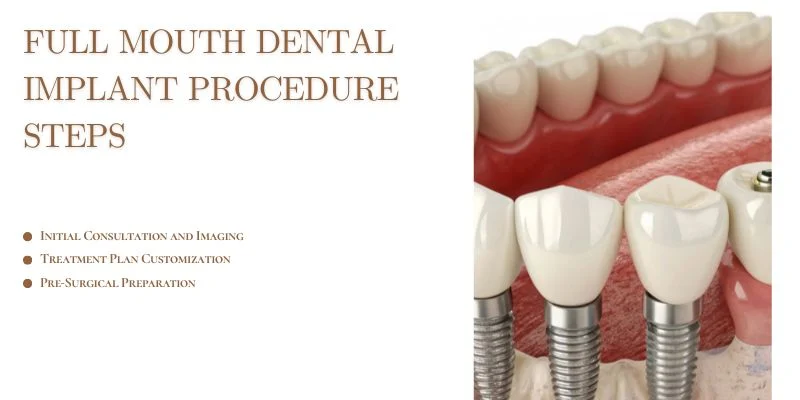 Full Mouth Dental Implant Procedure Steps