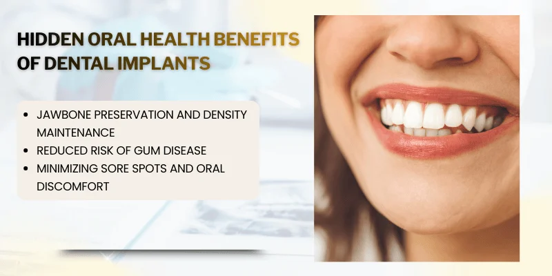 Oral Health Benefits of Dental Implants
