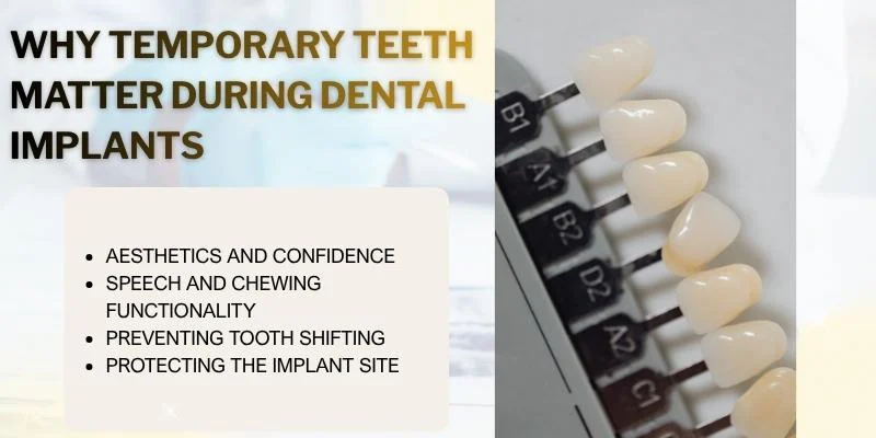 Why Temporary Teeth Matter During Dental Implants