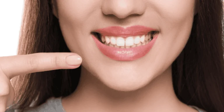 gum grafting after implant placement