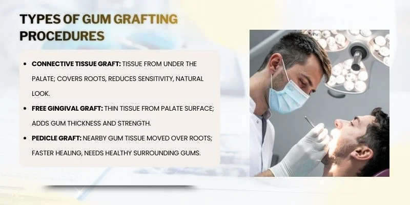 Types of Gum Grafting Procedures