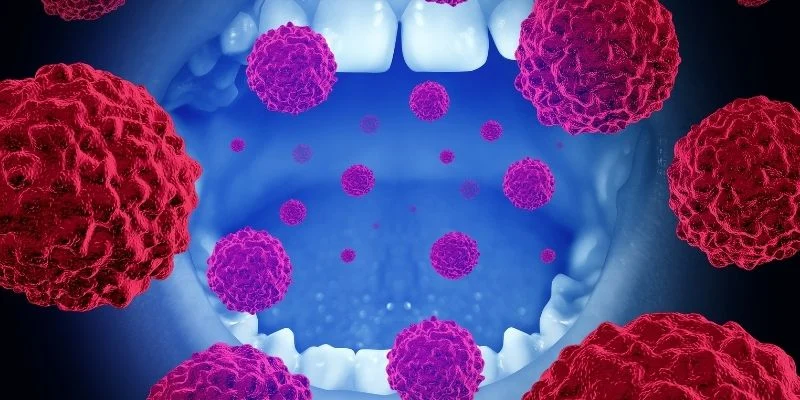 oral cancer