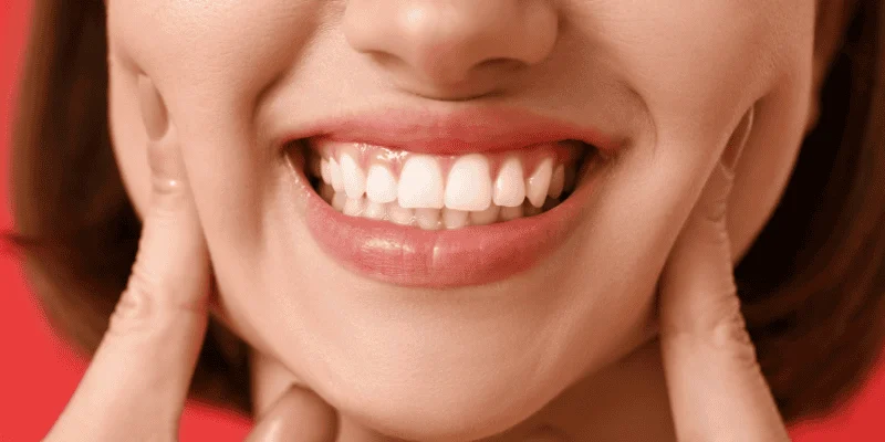 what makes dental implants permanent
